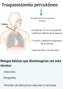 Traqueostomía percutánea